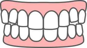 八重歯(叢生)の特徴
