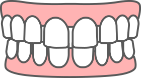 すきっ歯(空隙歯列)の特徴
